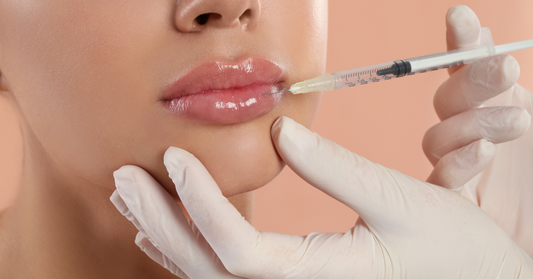 Mărire Buze București cu Acid Hialuronic în Clinicile aBeauty Clinique ®