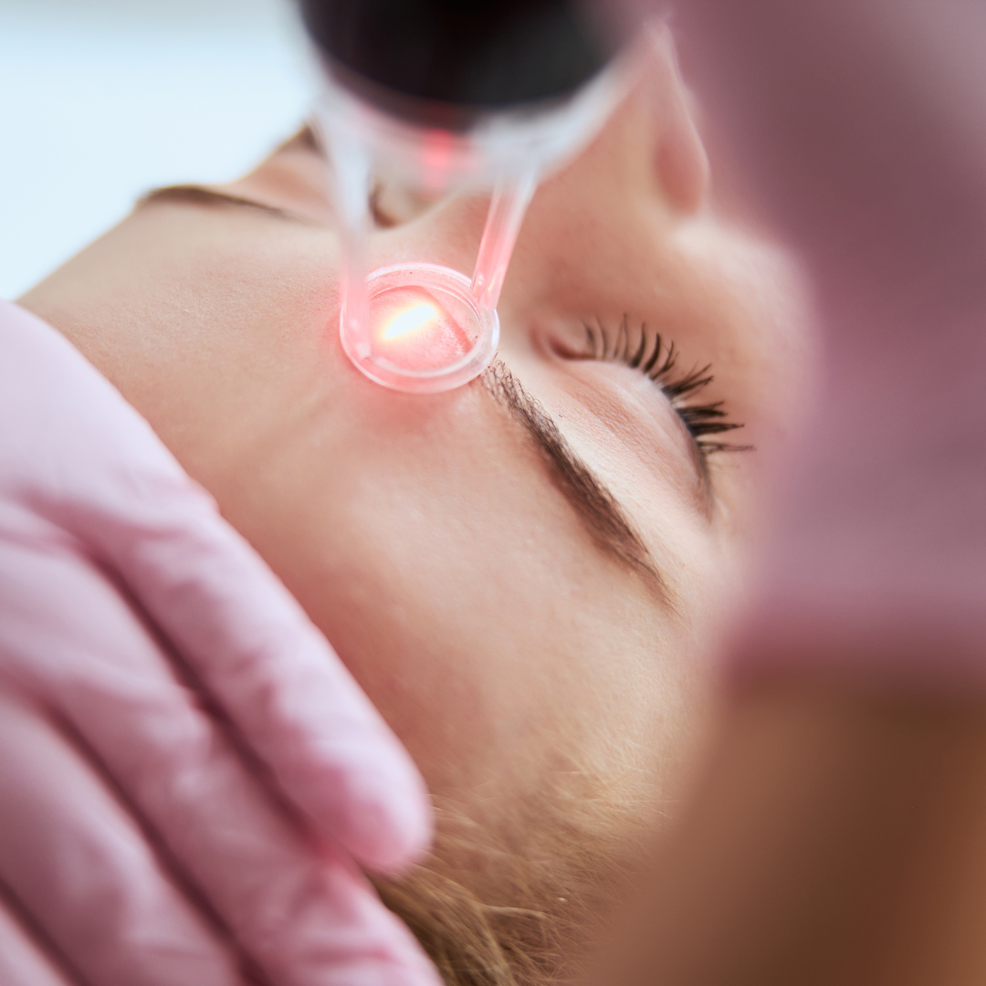 Tratament cu Laser CO2 Fracționat SNJ Finexel pentru Rejuvenare, Textură Uniformă și Fermitate