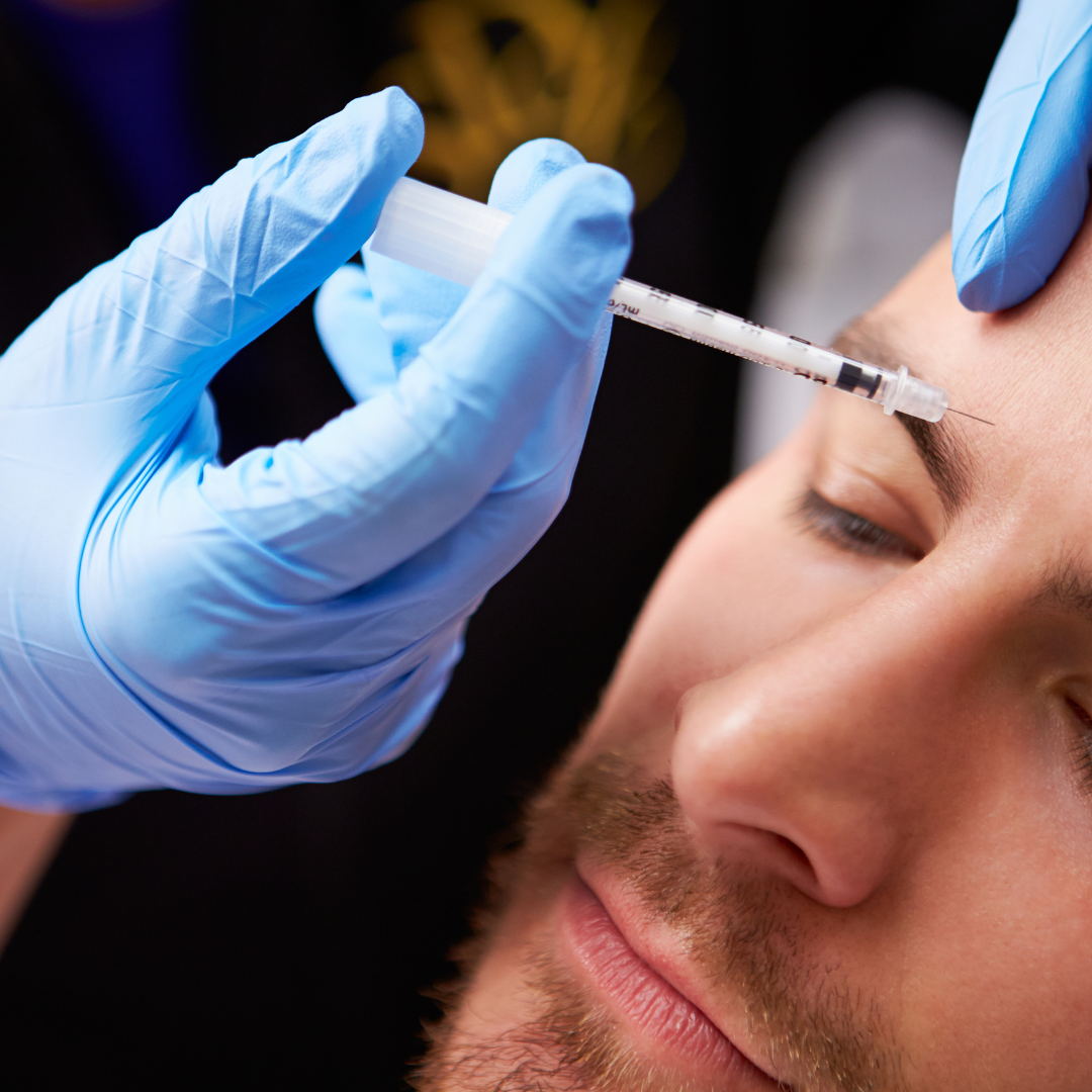 Tratament Riduri Bărbați 3-Point Refresh 50 unități – Întinerire Facială prin Relaxare Musculară