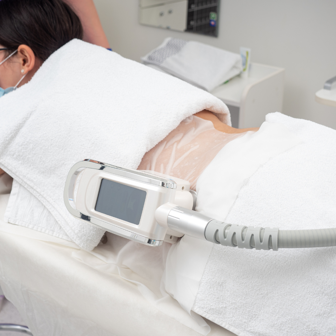 Tratament Corporal de Slăbire pentru Bărbați prin Criolipoliza Cryolipo