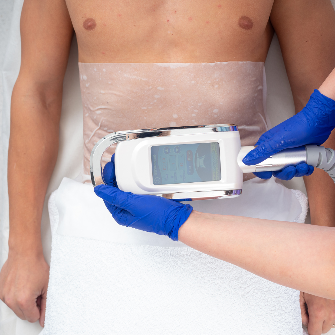 Tratament Corporal de Slăbire pentru Bărbați prin Criolipoliza Cryolipo