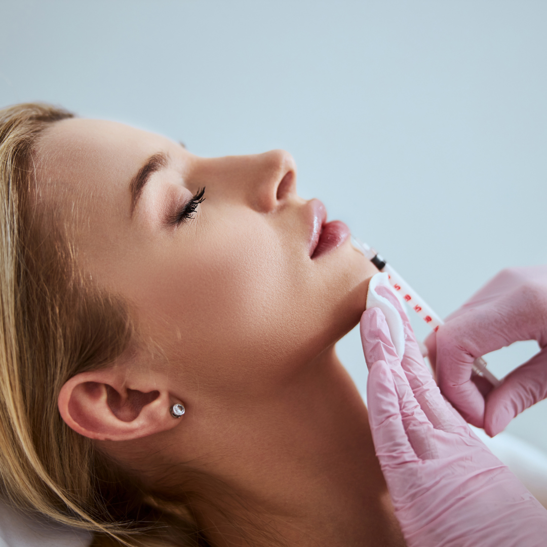Augmentare Buze cu Acid Hialuronic Amalian pentru Volum Elegant și Hidratare