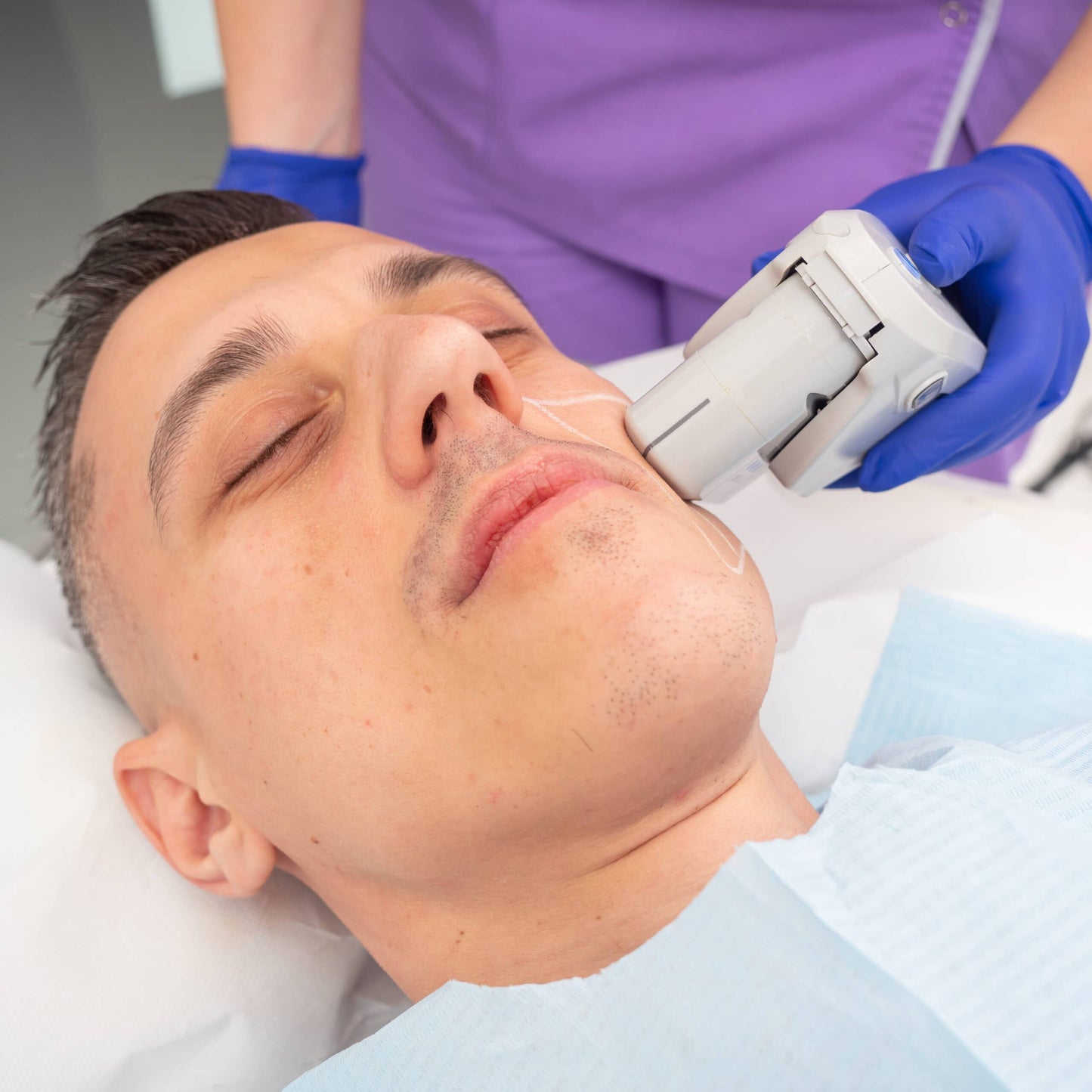 Tratament Facial FaceTight HIFU de Lifting Non-Invaziv