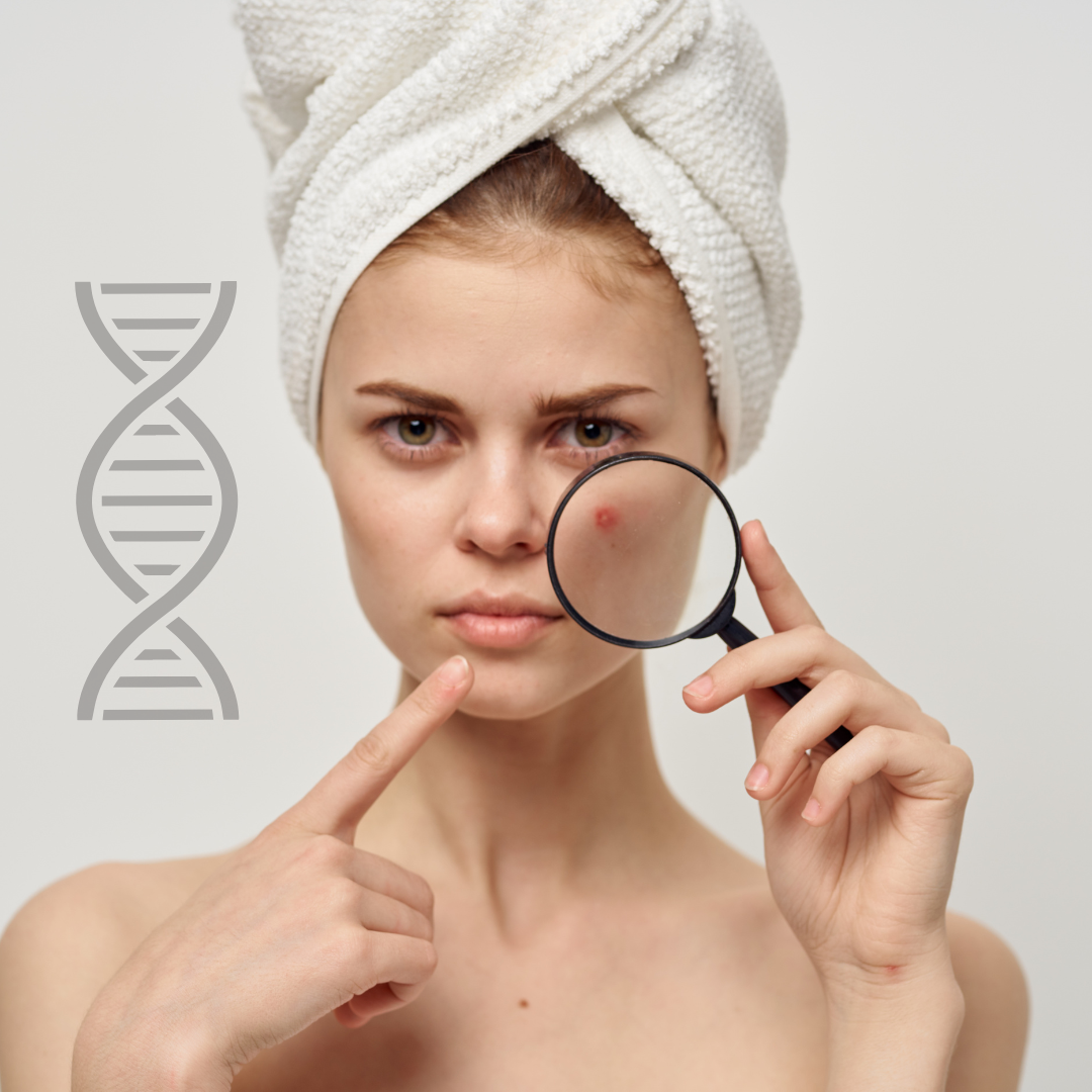Test ADN Anti-Acnee AcneTest SharpGenetics pentru Tratament Personalizat Ten Curat