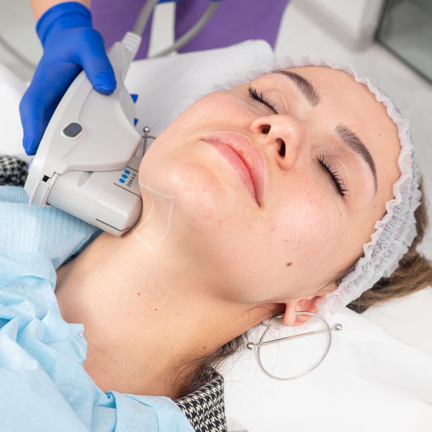 Tratament Facial FaceTight HIFU de Lifting Non-Invaziv