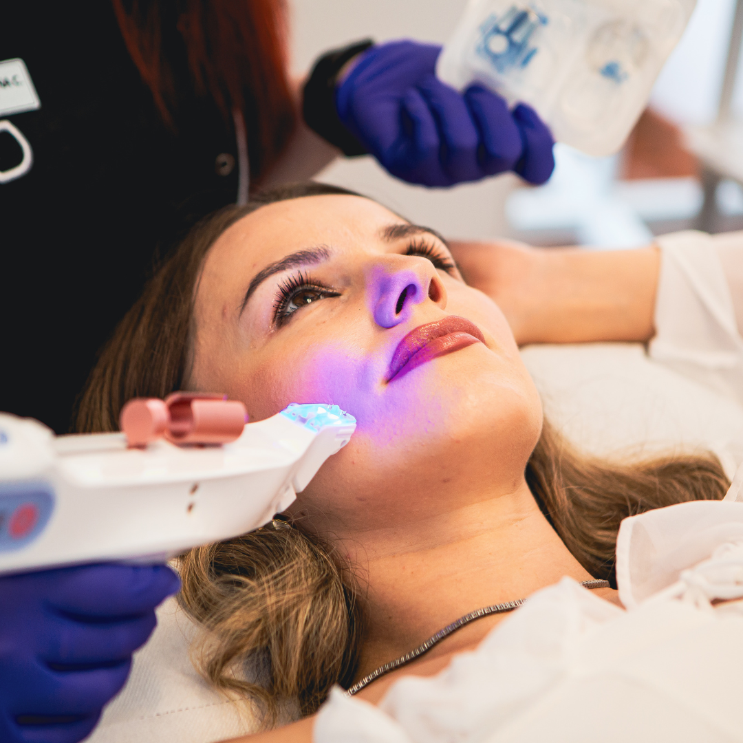 Tratament facial cu exozomi aplicat cu tehnologia SkinTera