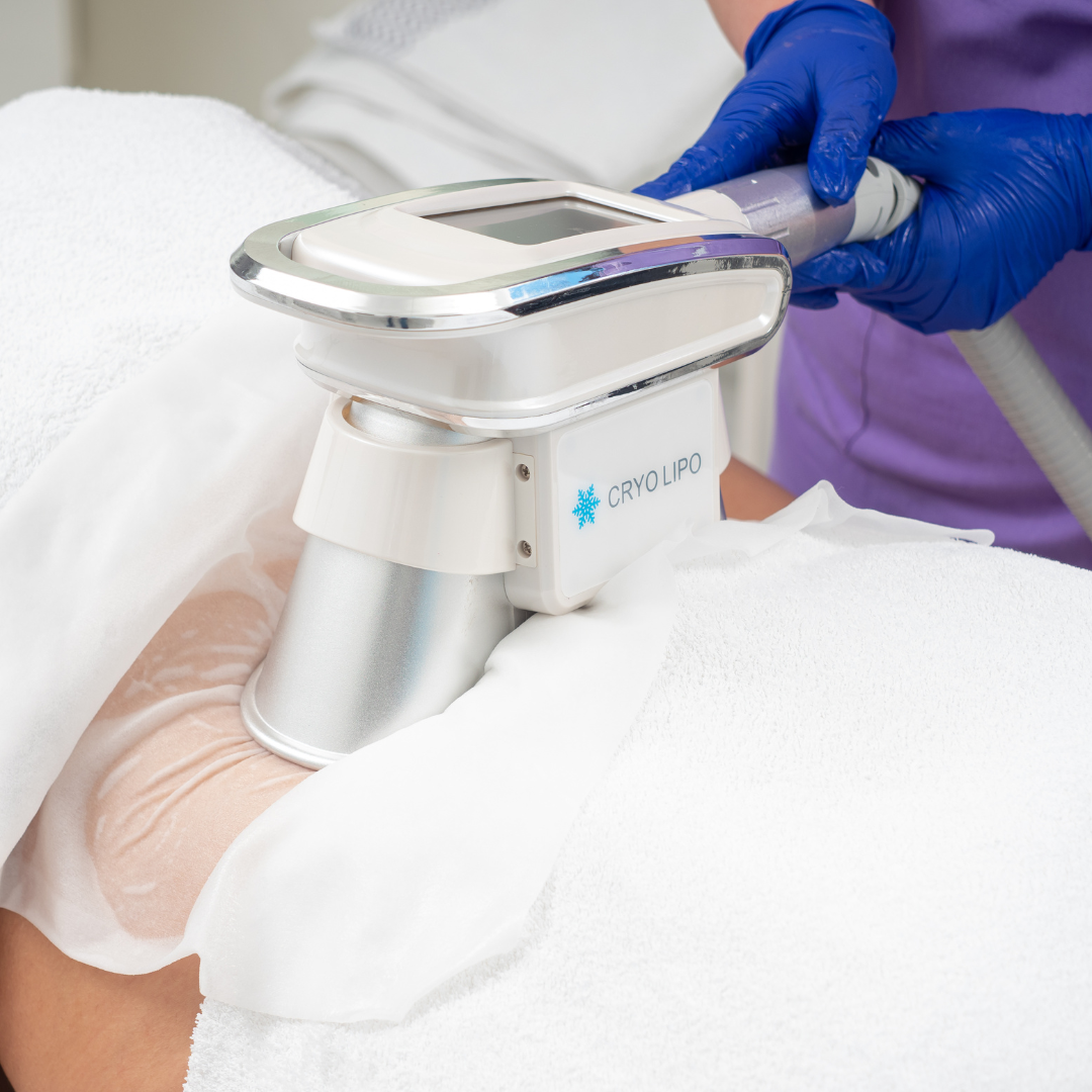 Tratament Corporal de Slăbire pentru Bărbați prin Criolipoliza Cryolipo