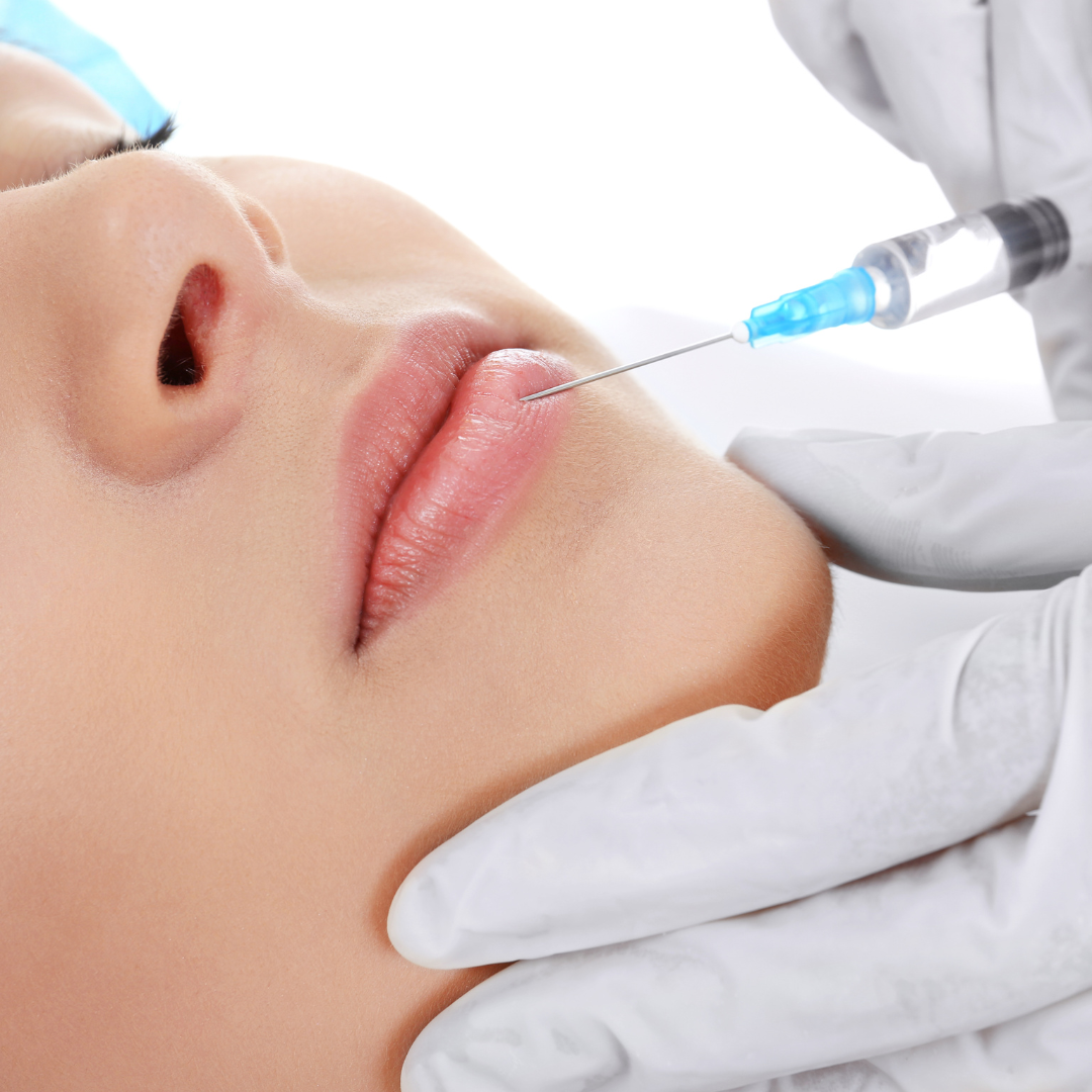 Augmentare Buze cu Acid Hialuronic Amalian pentru Volum Elegant și Hidratare