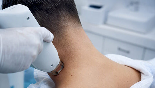Epilare definitivă cu laser pentru zona pieptului la bărbați