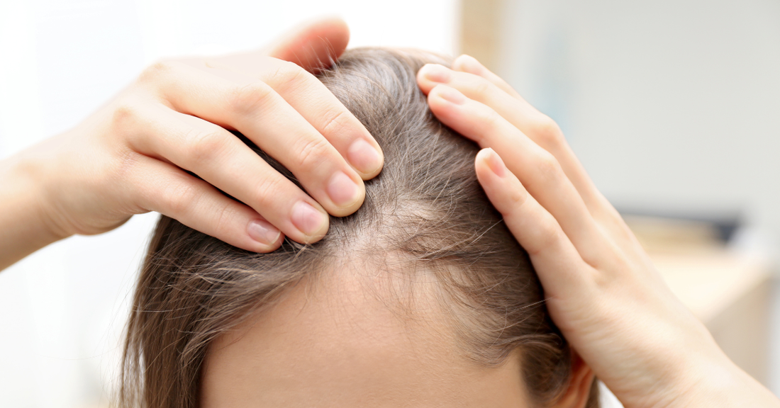 Tratamente alopecie și cădere păr în Craiova