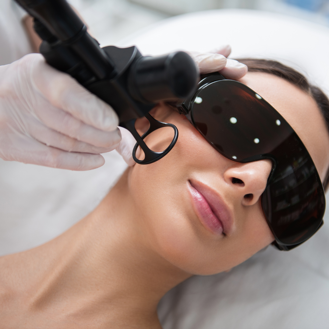 Tratament cu laser CO2 fracționat SNJ Finexel la aBeauty Clinique