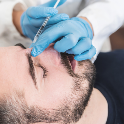 Tratament Riduri Bărbați 3-Point Refresh 50 unități – Întinerire Facială prin Relaxare Musculară