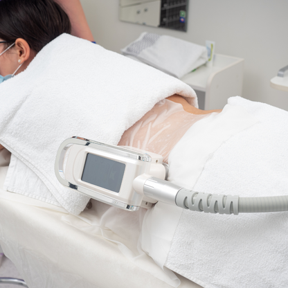 Tratament Corporal Criolipoliză CryoLipo de Slăbire Localizată prin Răcire Controlată
