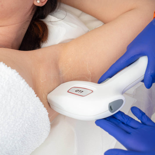 Epilare Definitivă cu Laser Formatk