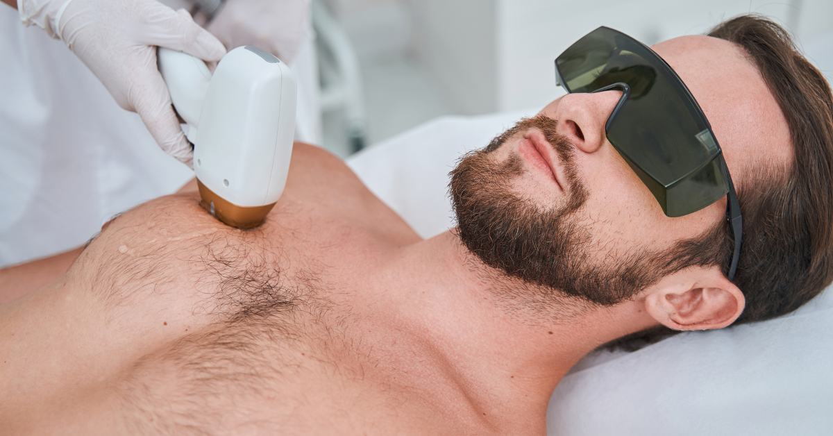 Epilare Laser Barbati