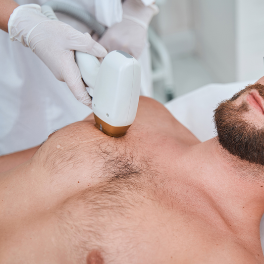 Epilare Definitivă Bărbați cu Laser Formatk