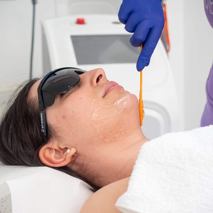 Epilare Definitivă cu Laser Formatk