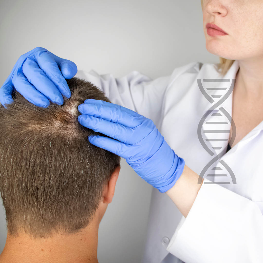 Kit Test ADN TrichoTest SharpGenetics anti-alopecie la aBeauty Clinique