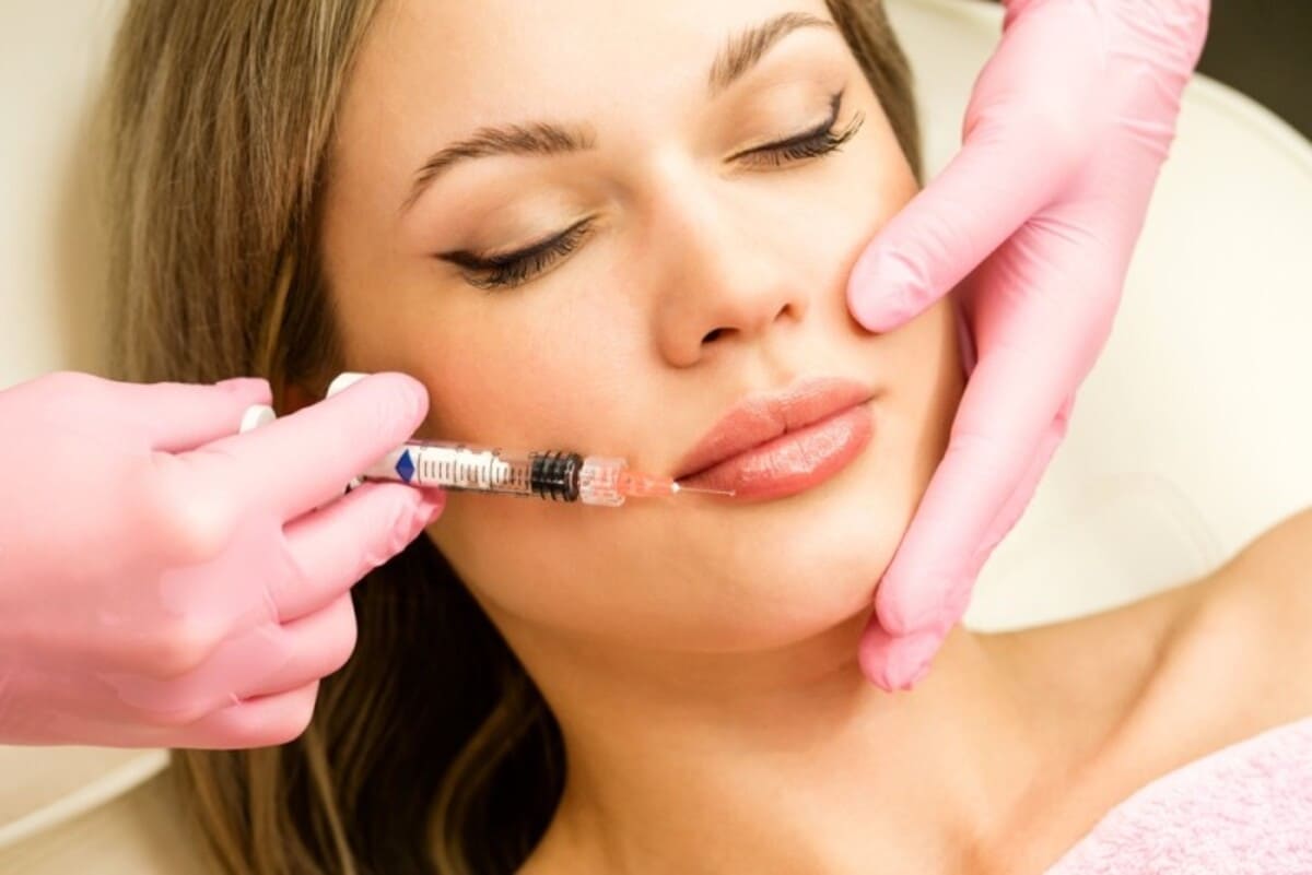 Medic care injectează acid hialuronic în buza unei paciente, cu mănuși