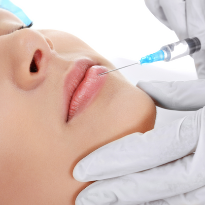 Augmentare Buze cu Acid Hialuronic Amalian pentru Volum Elegant și Hidratare